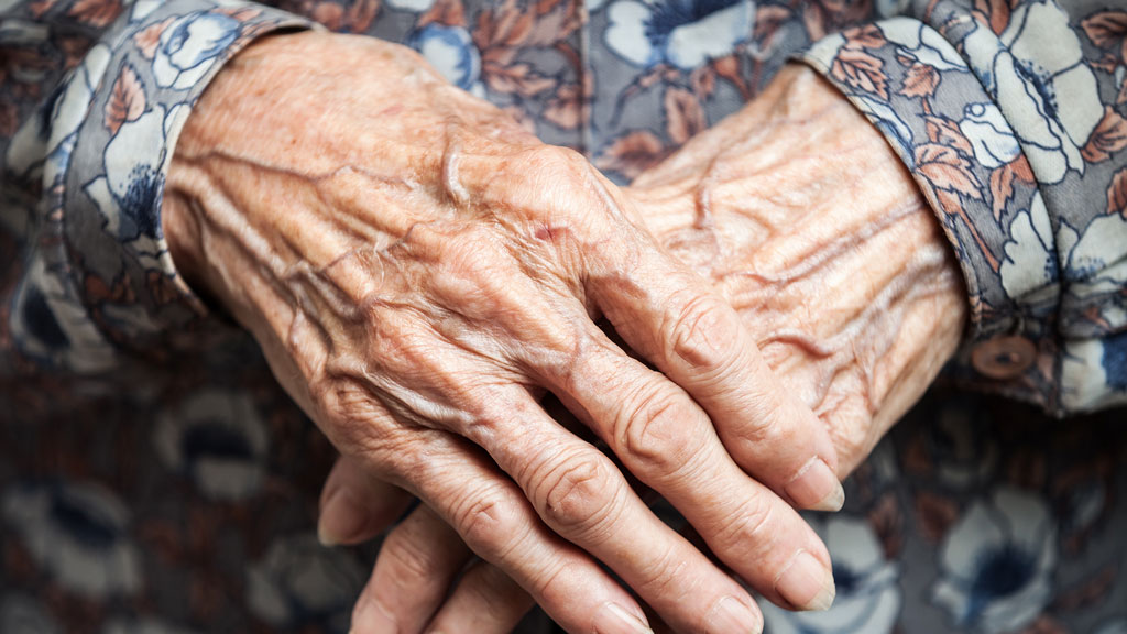 Arthritis: Sechs mögliche Formen & ihre Symptome